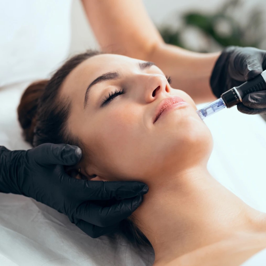 Microneedling